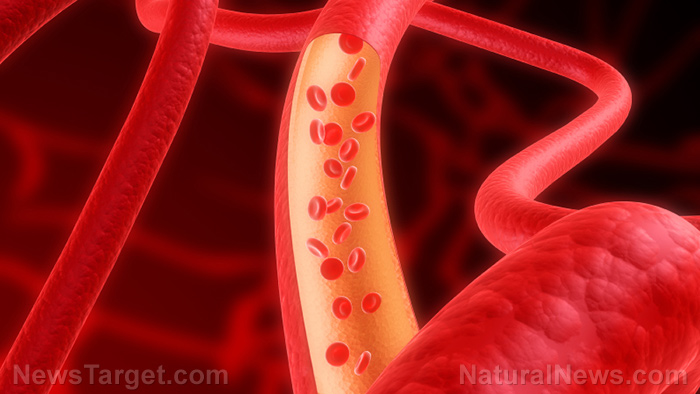 Natural remedies for clean arteries: Prevent cardiovascular disease with these 7 foods